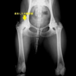 レッグぺルテス罹患症例の股関節のレントゲン写真