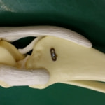 タイトロープ法