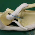 タイトロープ法