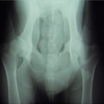 股関節疾患