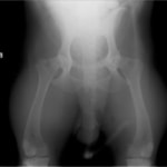 重度股関節形成不全の症例