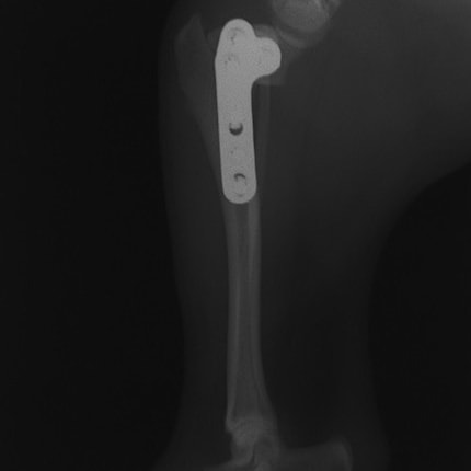 術後1ヶ月側面像